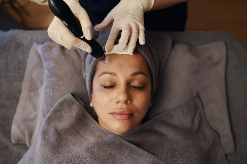 DiamondGlow facial for rosacea-prone skin at AURĀE Med Spa Mt. Pleasant